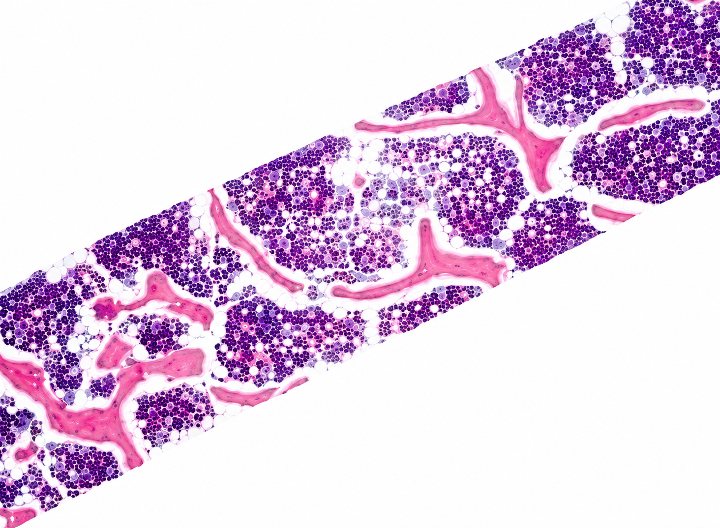 Histological section of cancellous bone — trabeculae and marrow cellularity