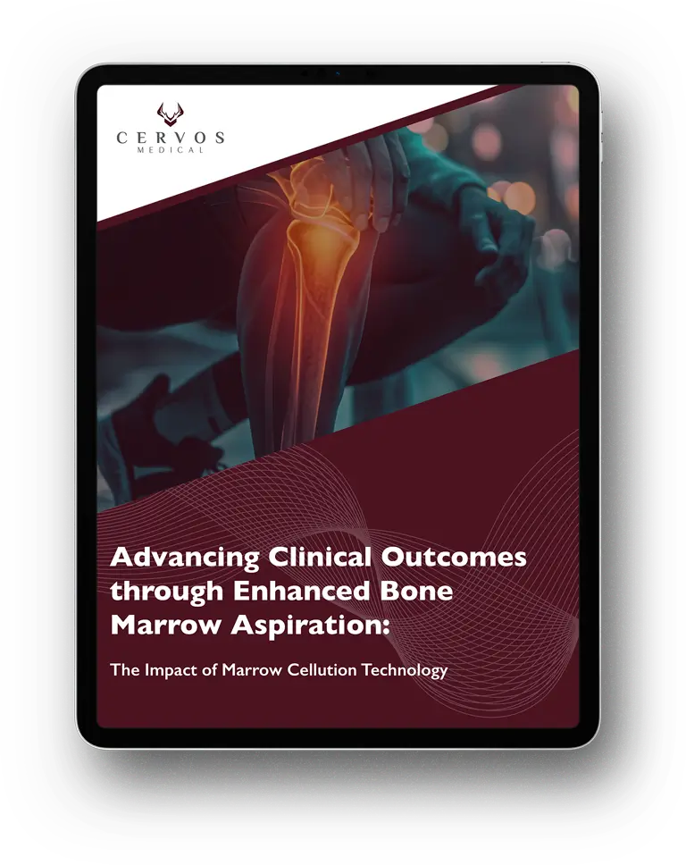 Advancing Clinical Outcomes through Enhanced Bone Marrow Aspiration